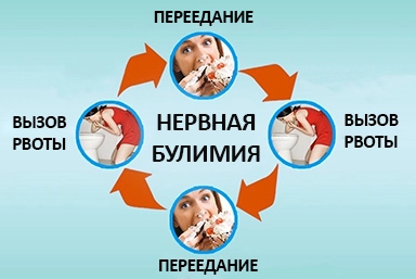 Лечение булимии в Мысках